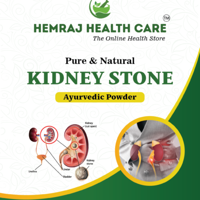 #Kidneystone #kidneystonetreatment