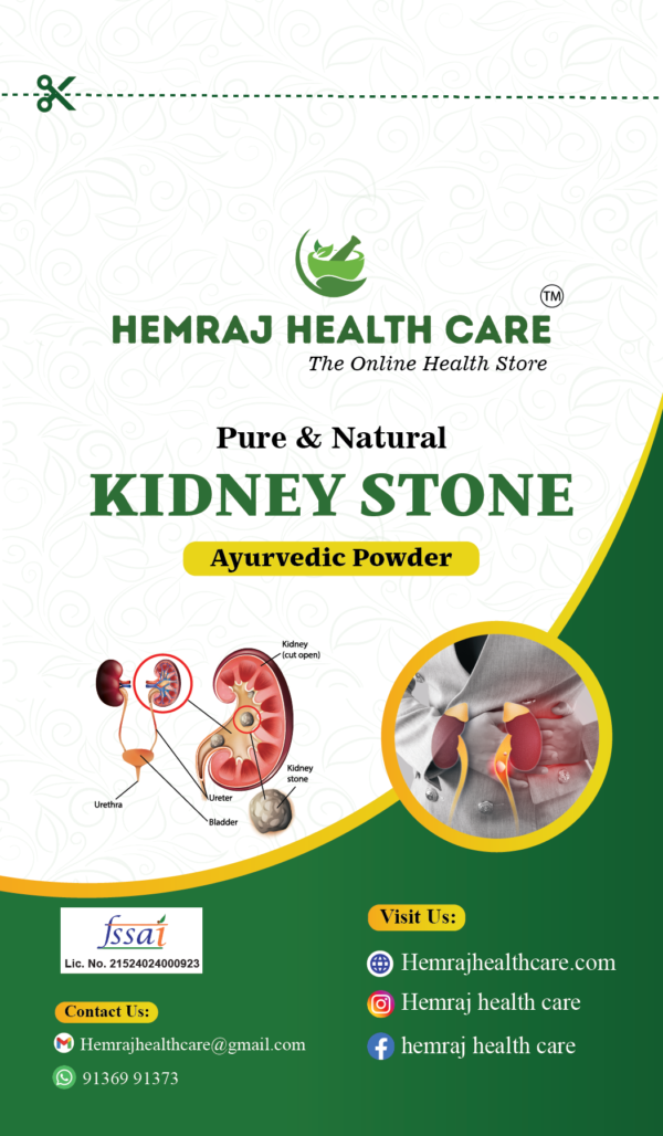 #Kidneystone #kidneystonetreatment