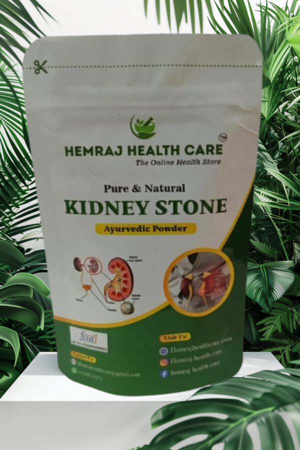 #Kidneystone #kidneystonetreatment